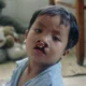 Smile Train charity rating overview and impact assessment